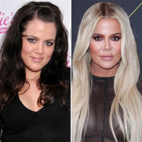 khloe kardashian plastic surgery pictures